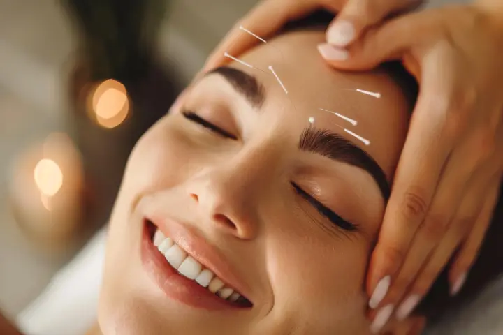 美容鍼とは？顔に鍼を刺す施術の基本